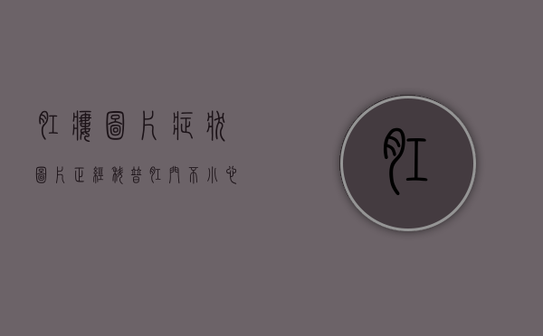 肛瘘图片症状图片（正经科普：肛门不小心被撑大了，还能恢复吗？万一卡住了怎么办？）
